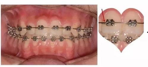 印尼巴士模拟器国产车辆模组 
